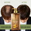Itch-Relief Nourishing Dandruff Shampoo