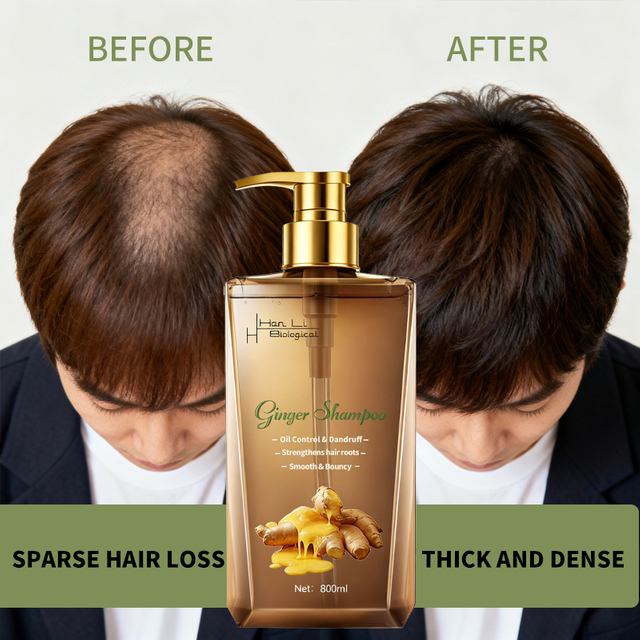 Itch-Relief Nourishing Dandruff Shampoo