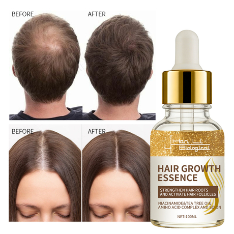 Hair Care Essential Oil for Deep Conditioning And Repair