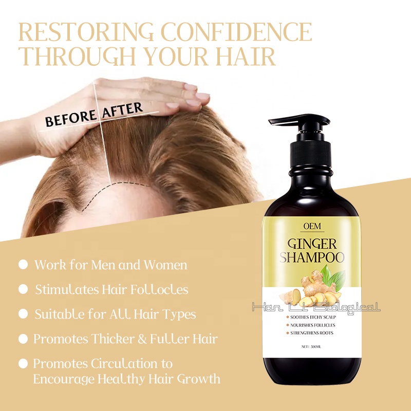 Ginger Extract to Control Oil and Remove Dandruff Shampoo 3