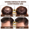 Hair Care Essential Oil for Deep Conditioning And Repair