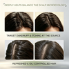 Anti Dandruff Shampoo